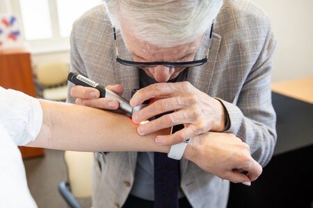 Dr Tomasz Mierzwa wykonuje badanie dermatoskopowe w kierunku czerniaka skóry, fot. Andrzej Goiński/UMWKP